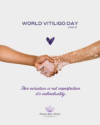 World Vitiligo Day